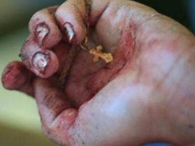 Πάτρα: Βάρβαρες επιθέσεις σε ηλικιωμένες...