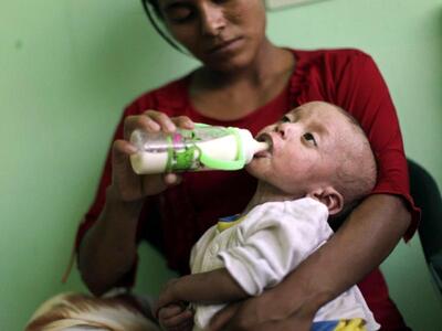 UNICEF: Σήμα κινδύνου για τον υποσιτισμό...