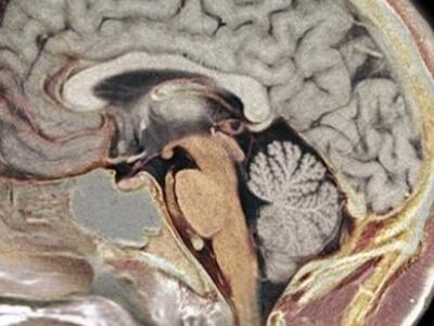 Οι τραυματισμοί στο κεφάλι τριπλασιάζουν...