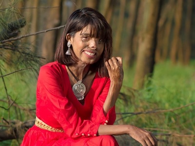 Έχασε το πρόσωπο της, τη δουλειά της και...