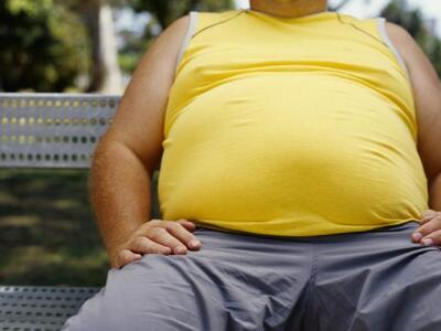 Η παχυσαρκία μπορεί να μειώσει το προσδόκιμο ζωής