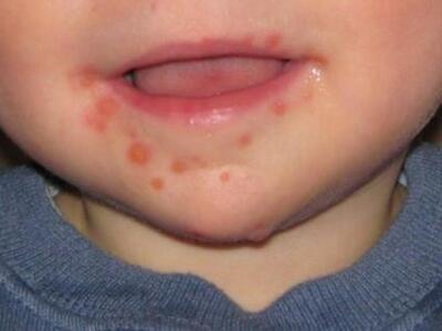 Μεσολόγγι: Ενημέρωση σχετικά με πιθανά κ...