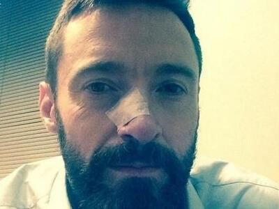 Για 2η φορά ο σταρ Χιου Τζάκμαν ήρθε αντ...