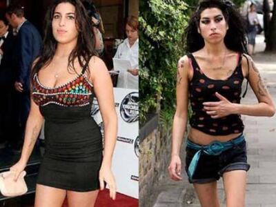 Γνωστοί καλλιτεχνες πριν και μετά τα... ...