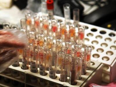 Φάρμακο μειώνει τις βλάβες μετά από έμφραγμα