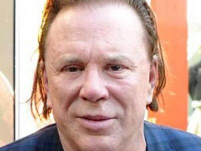 10 διάσημοι άντρες με αποτυχημένες πλαστικές