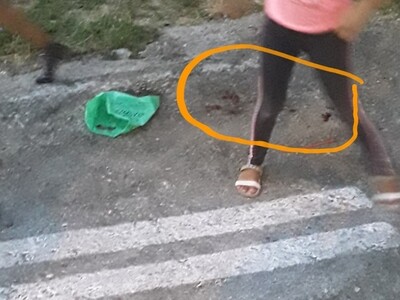 ΠΑΤΡΑ: Ξυλοκοπούσαν με ραβδιά σκαντζόχοιρους στον Φάρο! ΦΩΤΟ ΠΑΤΡΑ: Ξυλοκοπούσαν με ραβδιά σκαντζόχοιρους στον Φάρο! ΦΩΤΟ
