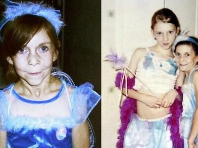 Δεκαεξάχρονη «εγκλωβισμένη» στο σώμα 60χρονης!