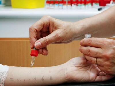 Αίγιο: Δωρεάν Αλλεργιολογικός Έλεγχος στ...