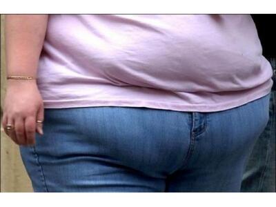 Μάστιγα η παιδική παχυσαρκία στην Ελλάδα
