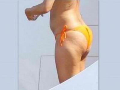 Τίγκα στην κυτταρίτιδα γνωστή και "...