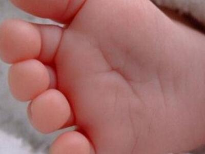 Νεφροπαθής που έπασχε και από «λύκο» κατ...