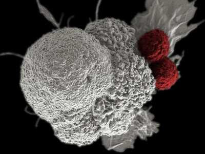 Επαναστατικό τεστ ανιχνεύει τον καρκίνο ...