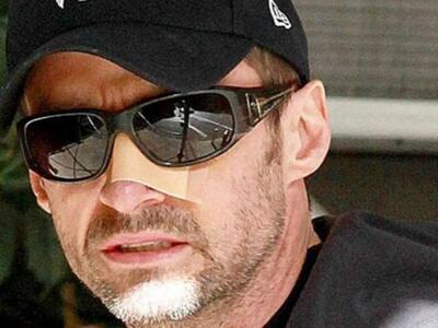 Η μάχη του Hugh Jackman με τον καρκίνο κ...