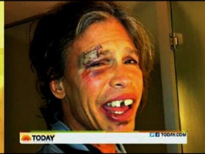 Δείτε τον Steven Tyler μετά την πτώση