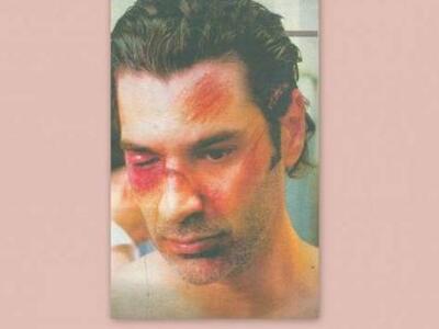 Ποιος έσπασε στο ξύλο τον Χριστόφορο Παπακαλιάτη;