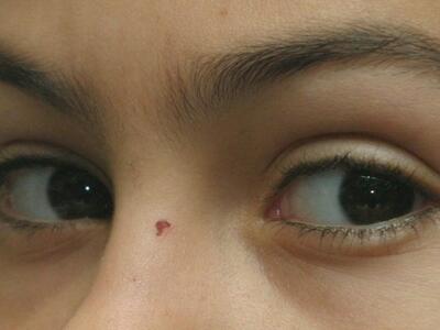 Έρχονται οι πρώτοι τηλεσκοπικοί φακοί επαφής