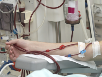 Νεφροπαθείς: Αύξηση των αποζημιώσεων για...