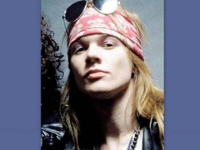 H σοκαριστική μεταμόρφωση του Axl Rose α...
