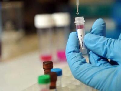 Δυτική Ελλάδα: Ο ιός της γρίπης "χτ...