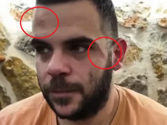 Ιωάννινα: Είχαν πετάξει και αυγά στον Yo...